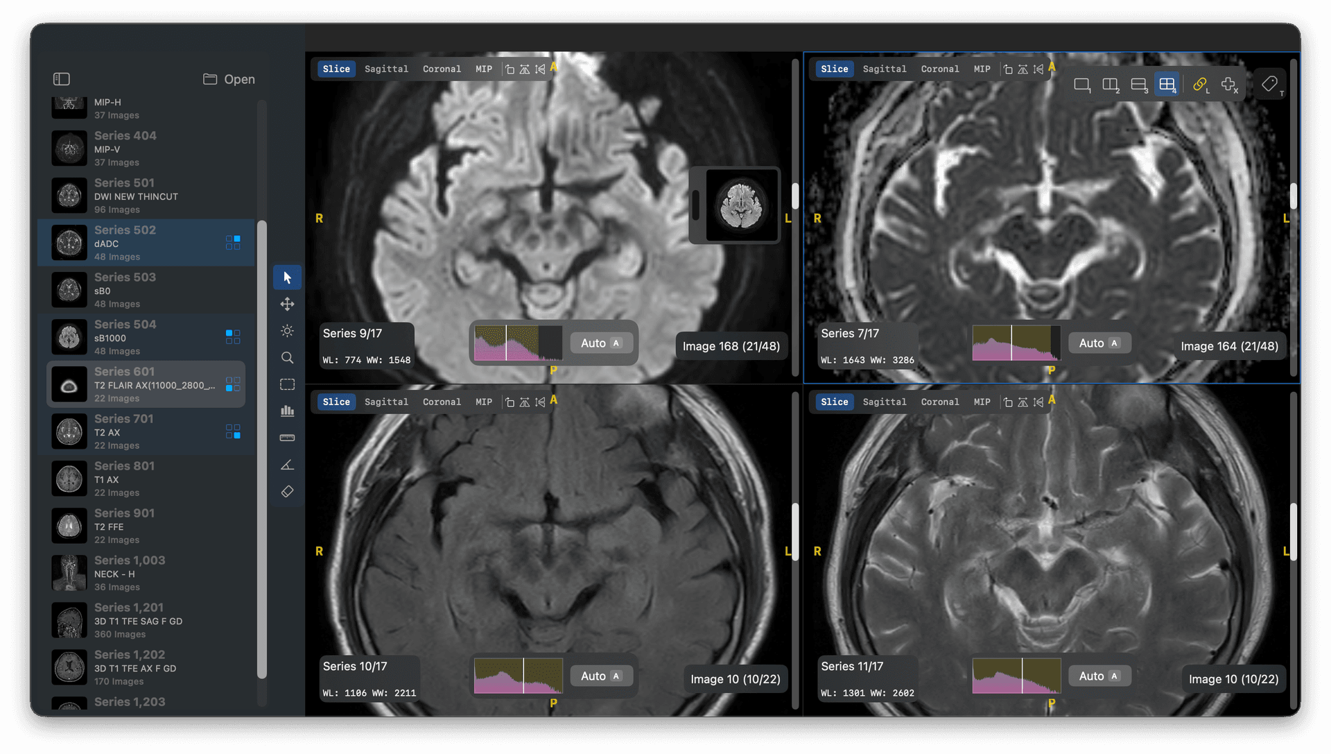 ODV-Annotate multi-panel DICOM viewer