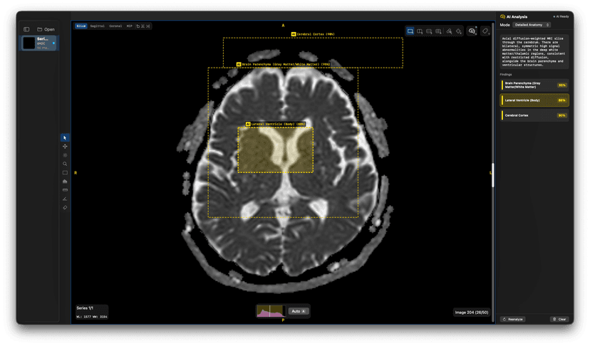 ODV-Annotate AI annotation with Gemma 4